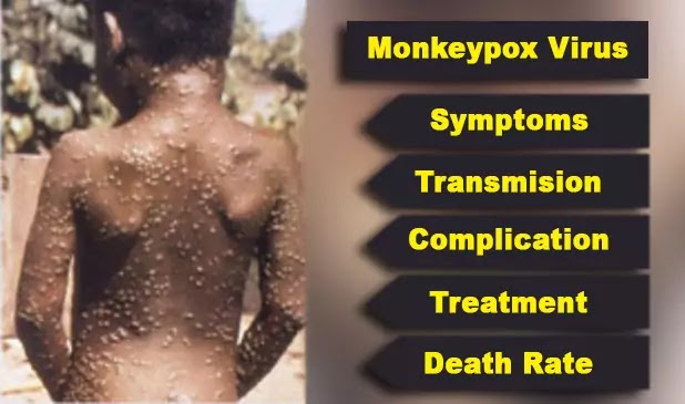 monkeypox 2Bvirus